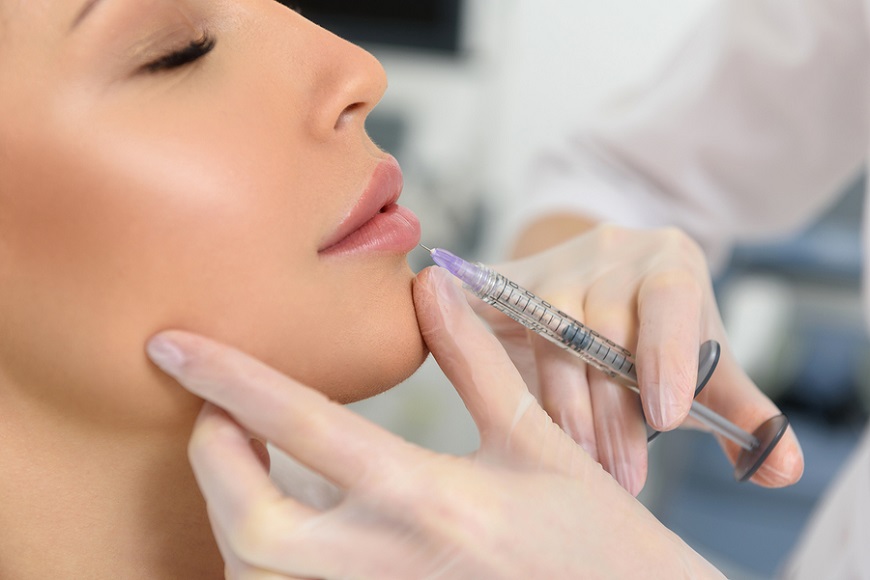Hyaluronic Fillers at Elite Plastic & Cosmetic Surgery Group Hyaluronic Fillers at Elite Plastic & Cosmetic Surgery Group