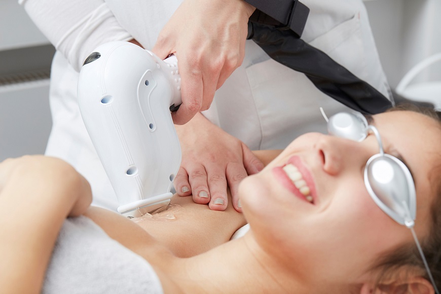 Offer: Buy 3 Sessions of Laser Hair Removal and Get 1 Free