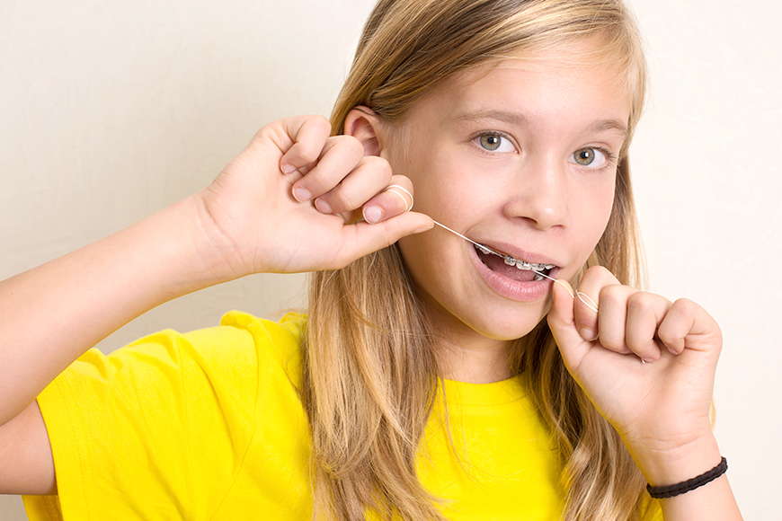 Can You Floss While Wearing Braces? Can You Floss While Wearing Braces?