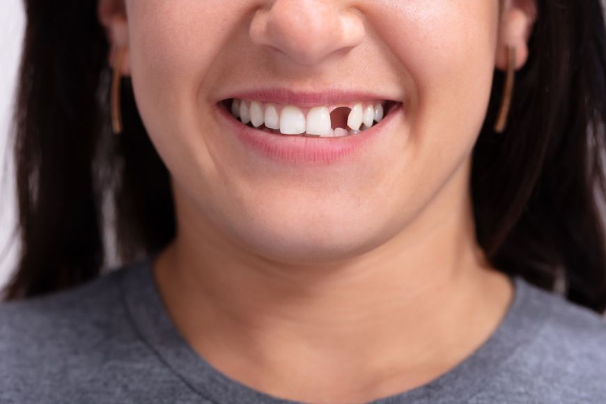 Dentist in Dubai | Drs. Nicolas & Asp Center Dentist in Dubai | Drs. Nicolas & Asp Center