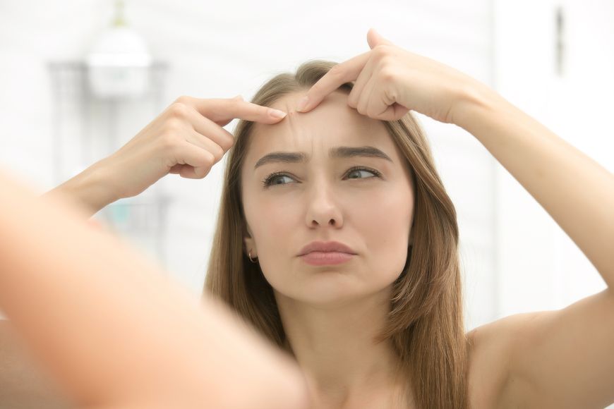 Adult Acne: Causes and Treatment in Dubai