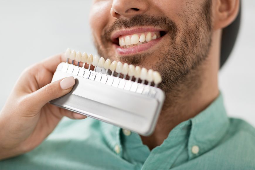 Dental Veneers in Dubai | Drs. Nicolas & Asp Dental Veneers in Dubai | Drs. Nicolas & Asp