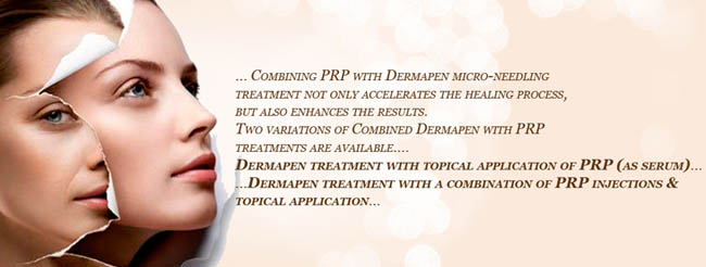 Dermapen Micro-Needling with PRP