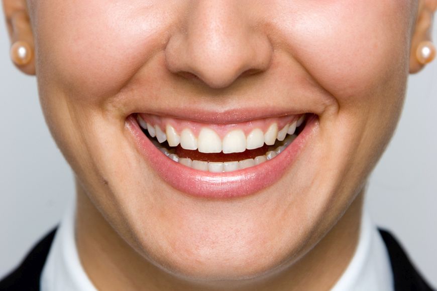 Gum Lift: Benefits, Procedure and Surgery in Dubai Gum Lift: Benefits, Procedure and Surgery in Dubai