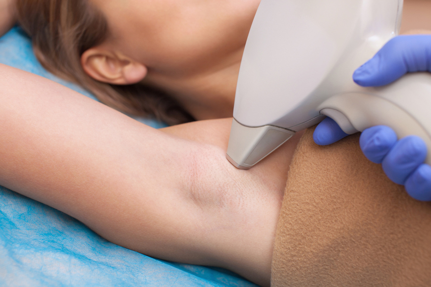 Laser Hair Removal in Dubai