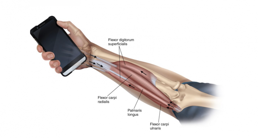 Carpal tunnel syndrome treatment in Dubai Carpal tunnel syndrome treatment in Dubai