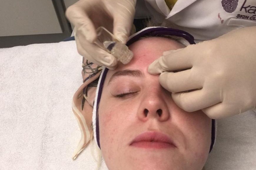 Review: Skin Cell Activation at Kaya Skin Clinic Review: Skin Cell Activation at Kaya Skin Clinic