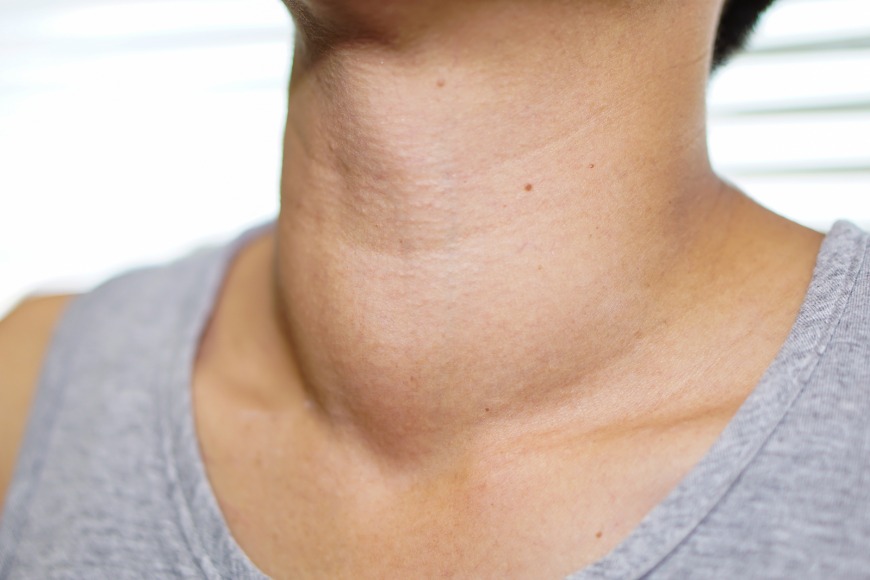 Thyroid problems in Dubai Thyroid problems in Dubai