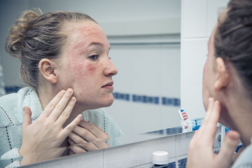 Most Common Dubai Skin Problems Most Common Dubai Skin Problems