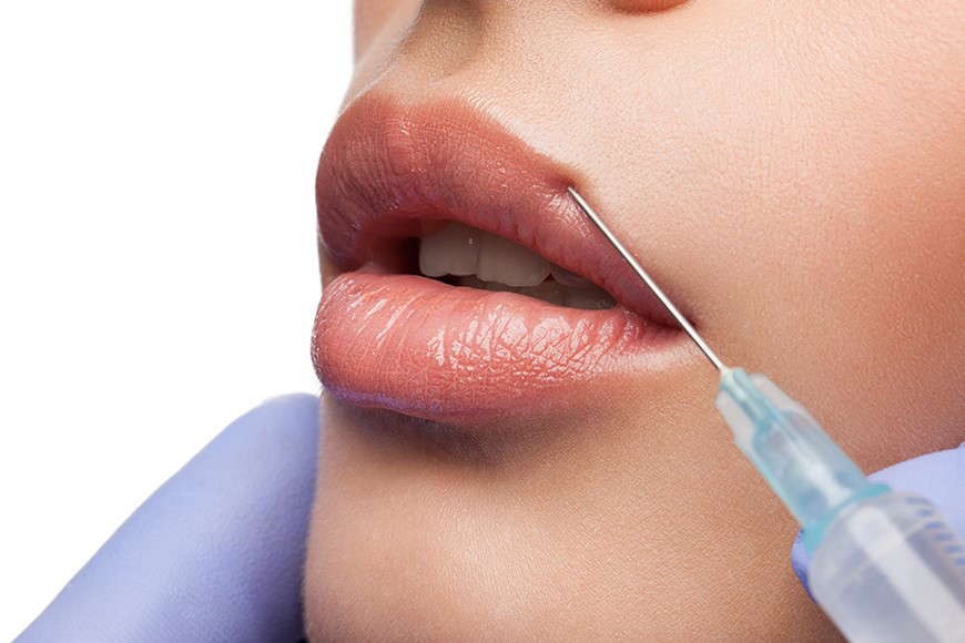 What is Hyaluronic Acid (HA) Filler? What is Hyaluronic Acid (HA) Filler?