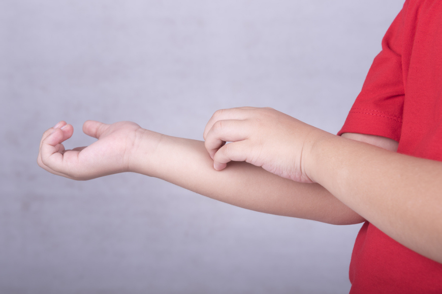 5 Telltale Signs of Childhood Allergy to Watch Out For in Dubai 5 Telltale Signs of Childhood Allergy to Watch Out For in Dubai