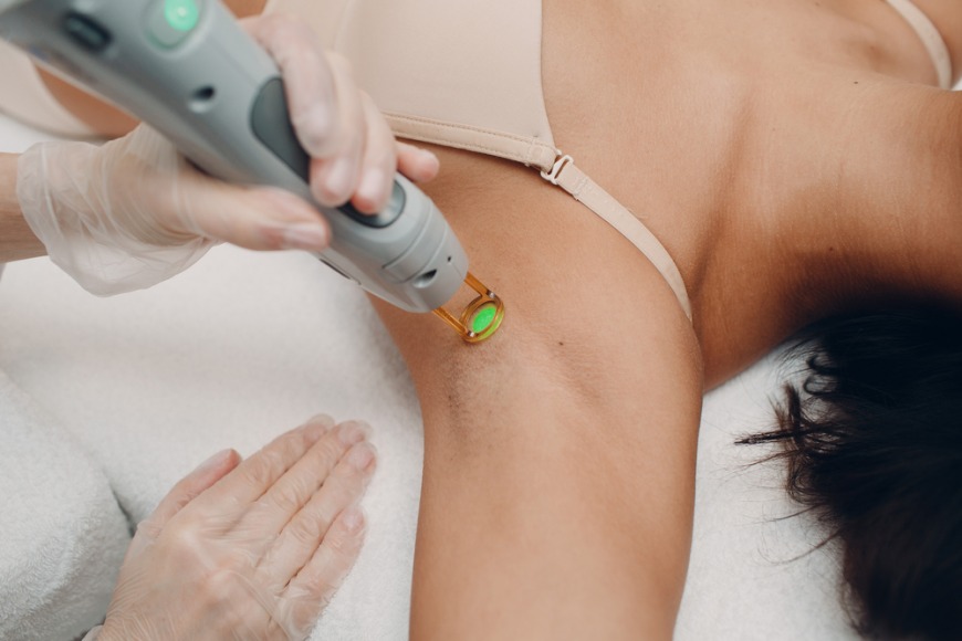 Best places for laser hair removal in Dubai Best places for laser hair removal in Dubai