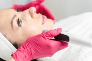 A guide to microneedling in Dubai